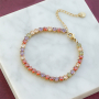 So setzen Sie Schmuck ins Blickfeld